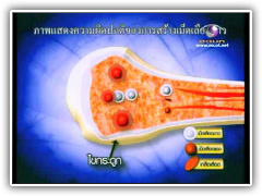 มะเร็งเม็ดเลือดขาว