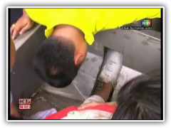 หนุ่มโรงงานพลาดมือติดเครื่องบดถั่ว