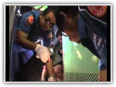 ผู้โดยสารรถไฟถูกเหล็กราวสะพานกระแทกขาหัก